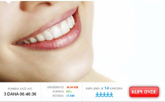 Platite 15 KM umjesto 40 KM i ostvarite 65% popusta na stomatološki pregled